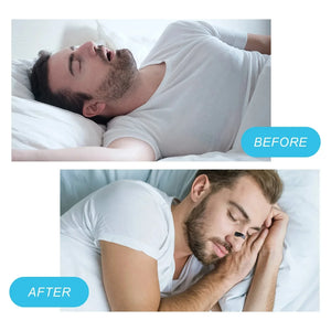 Hycor magnetic nose strips: increase sports air intake, improve sleep and reduce snoring